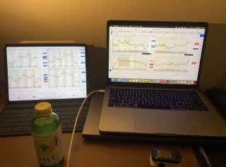 交易员心态问题之二:大亏小赚!